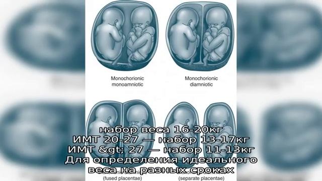 Многоплодная беременность. Беременность двойней: вес и живот, ощущения смотреть онлайн