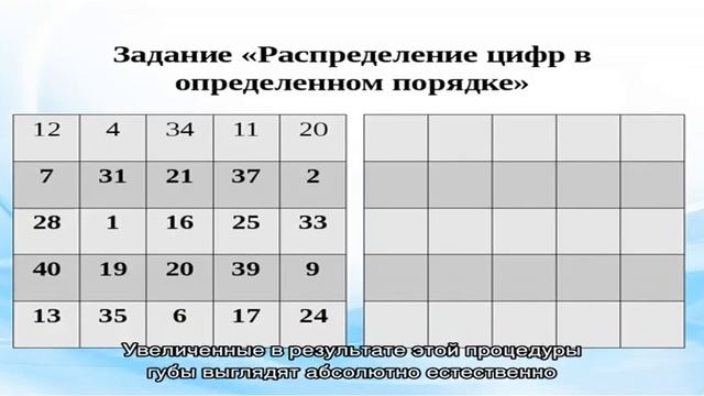Тредлифтинг: увеличение губ с помощью мезонитей смотреть онлайн