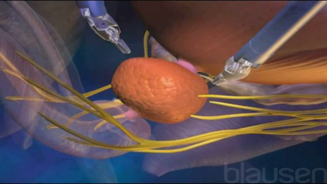 Виагра может уйти в историю, если один укол решит все проблемы