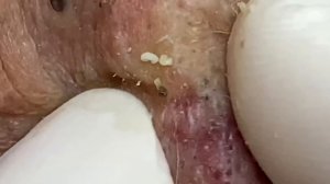 Enjoy Every Day With The Best Video Loan Nguyen Spa Official |  1386