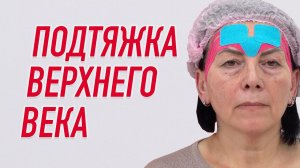 ✅ ПОДТЯЖКА ВЕРХНЕГО ВЕКА | Валентин Гайт | Учебный центр BBALANCE