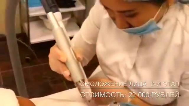 ЛАЗЕРНОЕ ОМОЛОЖЕНИЕ - FOTONA 4D смотреть онлайн
