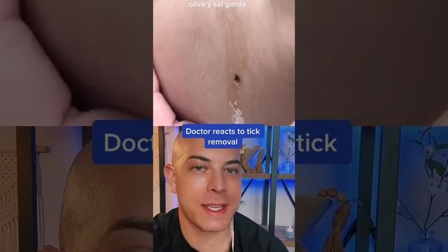 Crazy Tick Removal | Doctor Reacts смотреть онлайн