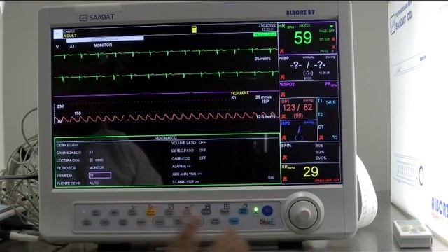 PARAMETRO DE ECG смотреть онлайн