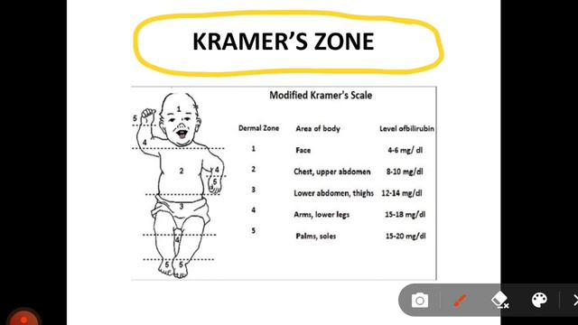 Quick Revision Series - Neonatology #pdcet #neetpg #neonatology #pediatrics смотреть онлайн