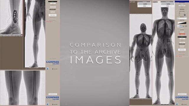 ADANI CONPASS SMART Security Xray body scanner inspection system with Artificial intelligence AI смотреть онлайн