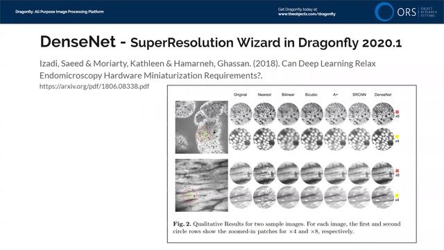 Dragonfly Daily 18 Super Resolution with Deep Learning in Dragonfly (2020) смотреть онлайн