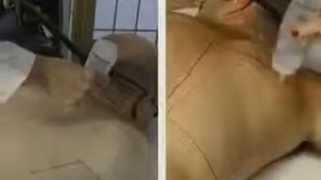 Candela GentleLase смотреть онлайн