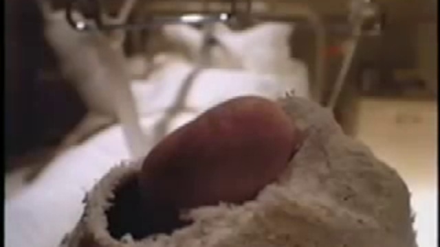 Рекламный ролик Got Milk: Тело в гипсе, 1995 год смотреть онлайн