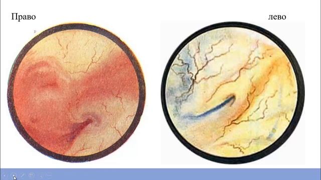 Анатомия нижних мочевыводящих путей: мочевой пузырь, предстательная железа, мочеиспускательный кана смотреть онлайн