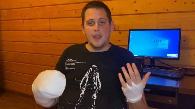 ПОЛУЧИЛ ТРАВМУ РАЗРЫВ СУХОЖИЛИЙ И НЕРВА / ЧЕРЕЗ СКОЛЬКО НАЧНУ РАБОТАТЬ? смотреть онлайн