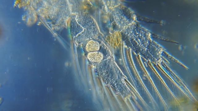 Конъюгация инфузорий смотреть онлайн