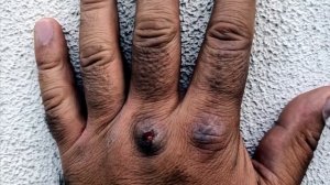 ВЫПУСК 2  Уроки карате   Набивка кулаков