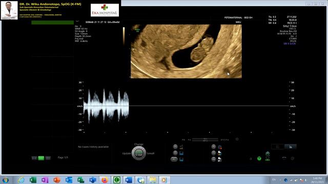 HAMIL NORMAL 8-9 MINGGU DENGAN MIOMA UTERI (Dr Wiku Andonotopo) смотреть онлайн