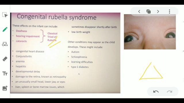 RUBELLA || INFECTIOUS DISEASE || GERMAN MEASLES || смотреть онлайн