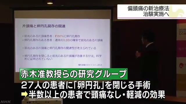 偏頭痛改善へ心臓手術治験 смотреть онлайн