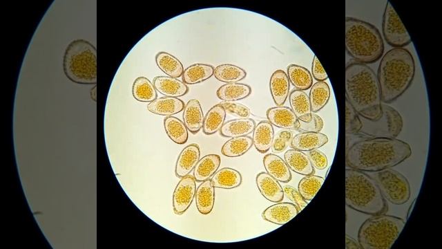 Puccinia graminis ex Festuca arundinacea