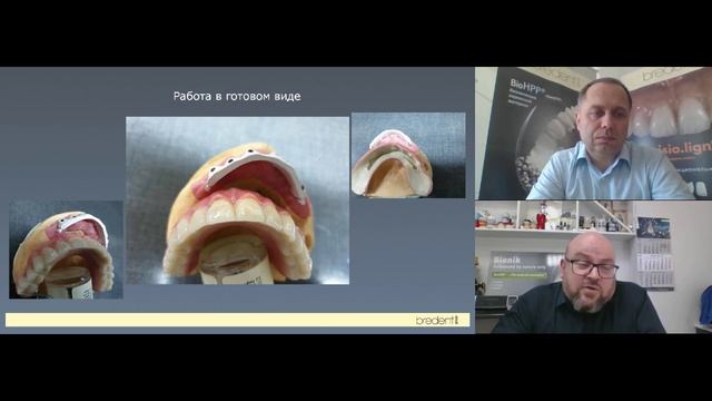 Новые возможности в классических ортопедических работах благодаря новым инновационным материалам смотреть онлайн