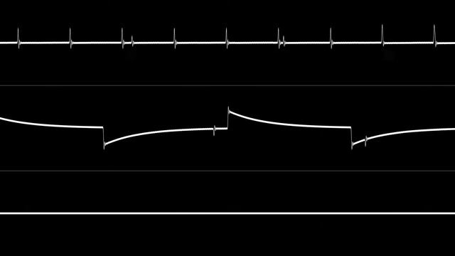 shiru8bit - Fase Uno (ZXS 48k) (out of sync for some reason) смотреть онлайн