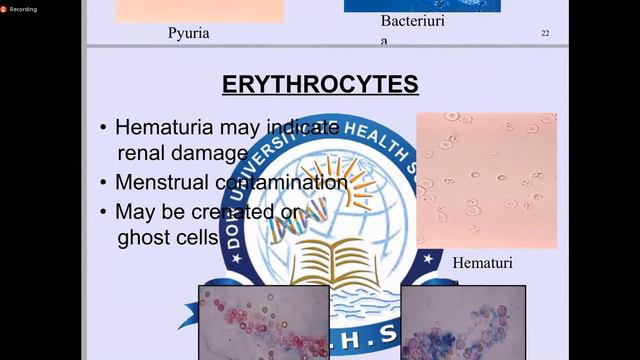 Investigation of Renal & Urinary Diseases | Medicine смотреть онлайн