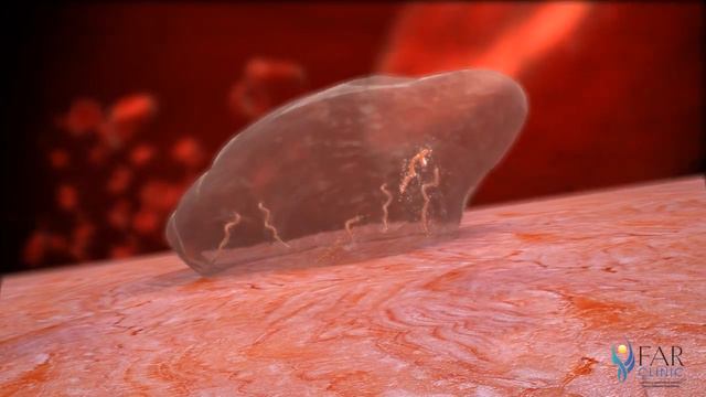 Actions of Lyme Spirochetes (Borrelia Burgdorferi) смотреть онлайн