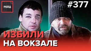 СИЛЬНОЕ ОБМОРОЖЕНИЕ | ТРИ ДНЯ БЕЗ ЕДЫ | УКРАЛИ ДОКУМЕНТЫ | ЖИВЕТ ПОД ЛЕСТНИЦЕЙ - Рейд 377