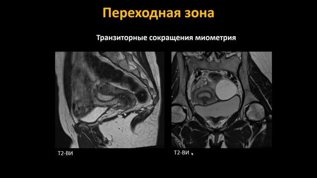 Базовый курс МРТ Лекция «МР анатомия женского таза и методика сбора данных»  Лектор  Трофименко И А