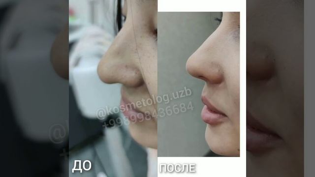 KOSMETOLOG #cosmetology #kosmetolog #uzb #косметолог #ozbekiston #ташкент #talim #косметология
