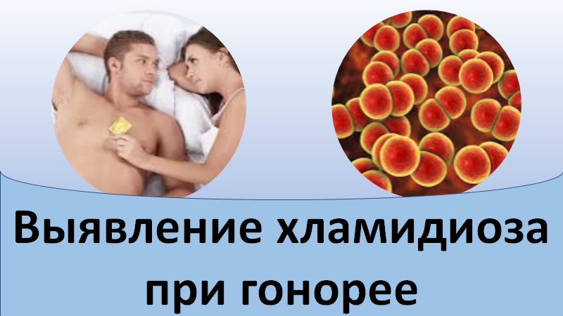 Выявление хламидиоза при гонорее смотреть онлайн