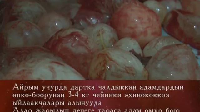 Эхинококкоз 34 секунды смотреть онлайн