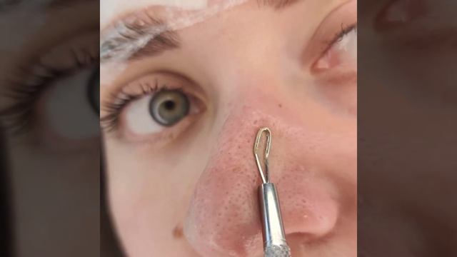 Чистим кожу с помощью салфеток от черных точек и закупоренных пор Ciracle смотреть онлайн