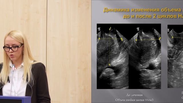 Результаты лечения больных РШМ в зависимости от гистологического строения опухоли