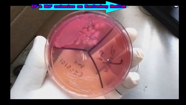 MacConkey Medium Showing  Lactose And Non Lactose Fermenter Colonies
