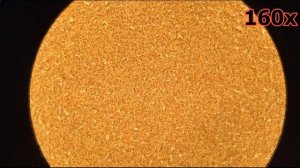 Шок! Кровь Под Микроскопом После Кофе!  Blood After Coffee under the Microscope