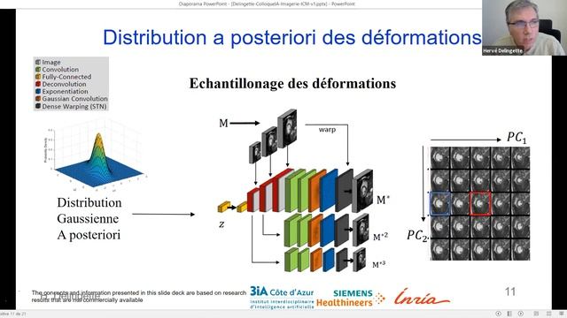 Herve Delingette смотреть онлайн