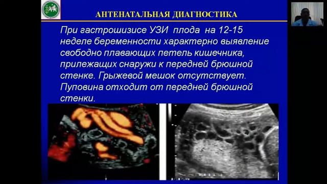 История равзития детской хирургии Основоположники детской хирургии в Узбекистане Современные лабо смотреть онлайн