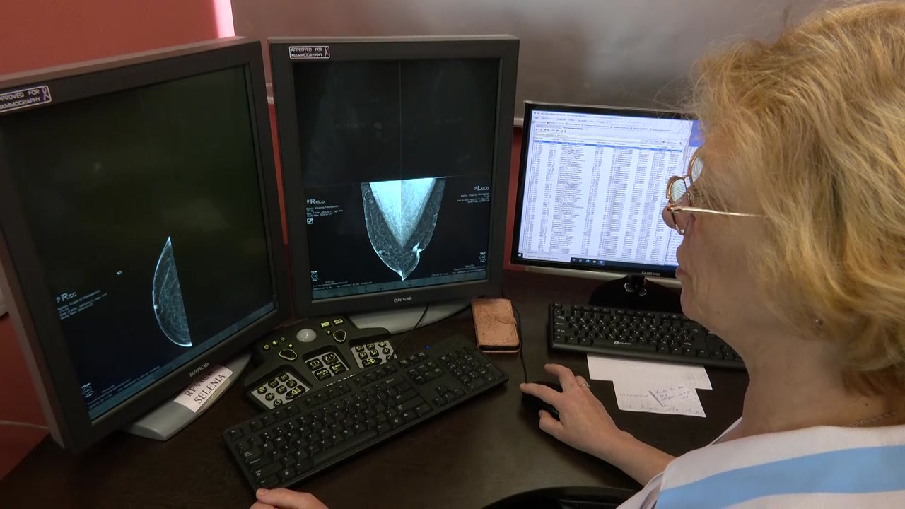 В Костромской области растет доля онкозаболеваний, выявленных на ранней стадии