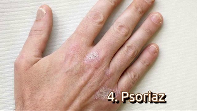 Цынковый мазьнинг соглик ва гузаллик учун хайратланарли фойдалари смотреть онлайн