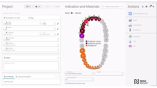 How to set up your NobelProcera® Full-contour Zirconia Implant Bridge case using exocad™ смотреть онлайн