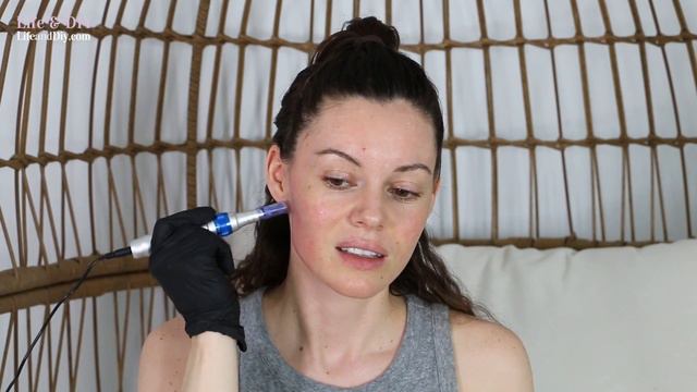 3rd Microneedling Treatment at Home with the Dr. Pen смотреть онлайн