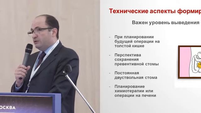 Кишечные стомы показания, технические аспекты, осложнения смотреть онлайн