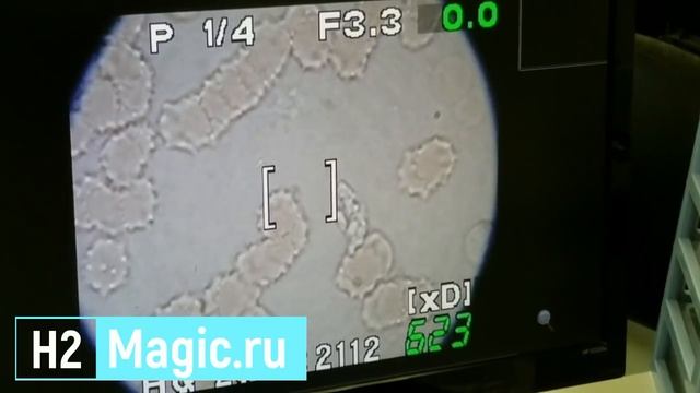 H2Magic: Тест с микроскопом. Так быстро свежая водородная вода восстанавливает эритроциты лейкоциты смотреть онлайн