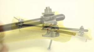 Практическое занятие «Внешний остеосинтез аппаратом КСВП»