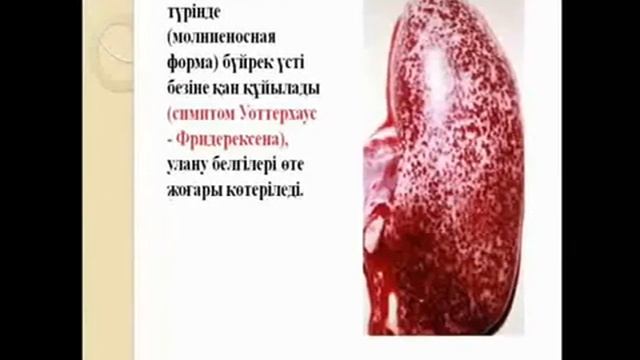 Менингококкты жұқпалы аурулар смотреть онлайн