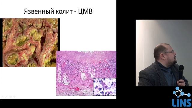 Бердников Р.Б. Актуальные вопросы патологии ВИЧ-инфекции