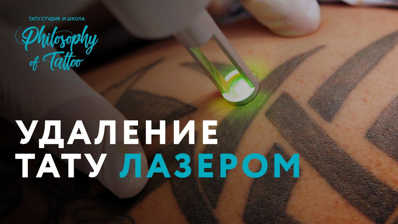 УДАЛЕНИЕ ТАТУИРОВКИ ЛАЗЕРОМ | ВСЁ О ЛАЗЕРНОМ УДАЛЕНИИ смотреть онлайн