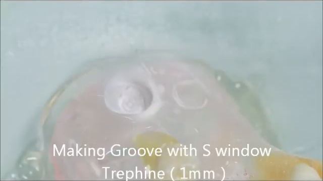 S Window Opening kit смотреть онлайн