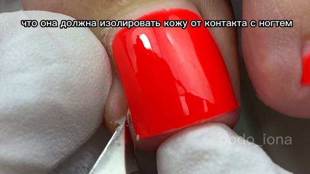 Ошибка в установке тампонады #подология #подологмосква #курсыпедикюра #вросшийноготь #вросшие смотреть онлайн
