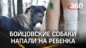 Бойцовские собаки порвали ребенка в Ярославле – пьющие хозяева выпускали псов гулять без присмотра