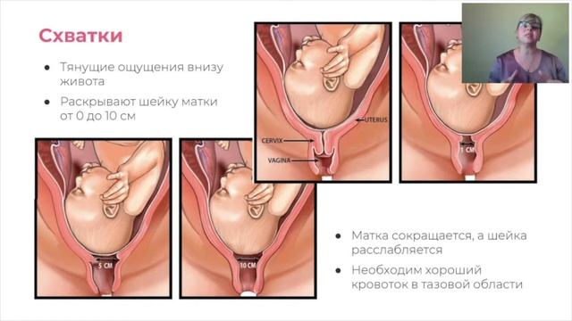 Что такое схватки и как повысить их эффективность смотреть онлайн